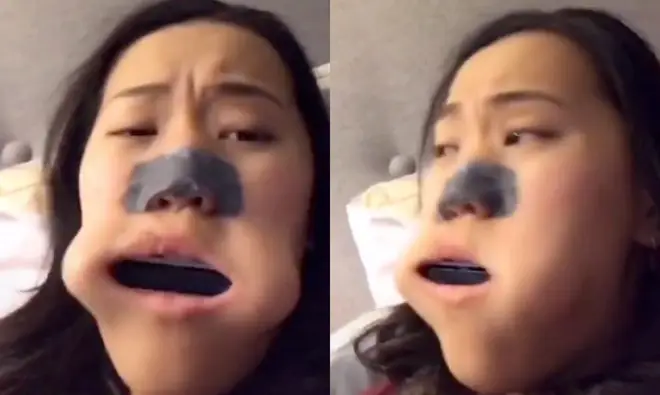 A girl got a whole harmonica stuck inside her mouth