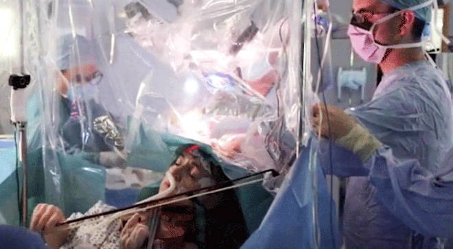 Woman plays violin during brain surgery to save her musical skills