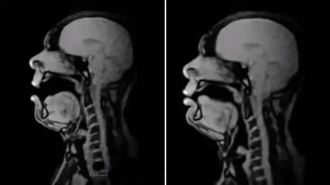 Baritone sings in an MRI scanner